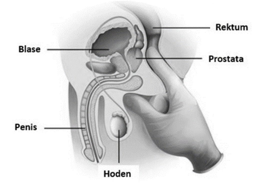 Gesundheitscheck - Prostatauntersuchung - Körpercheck by PhoVid