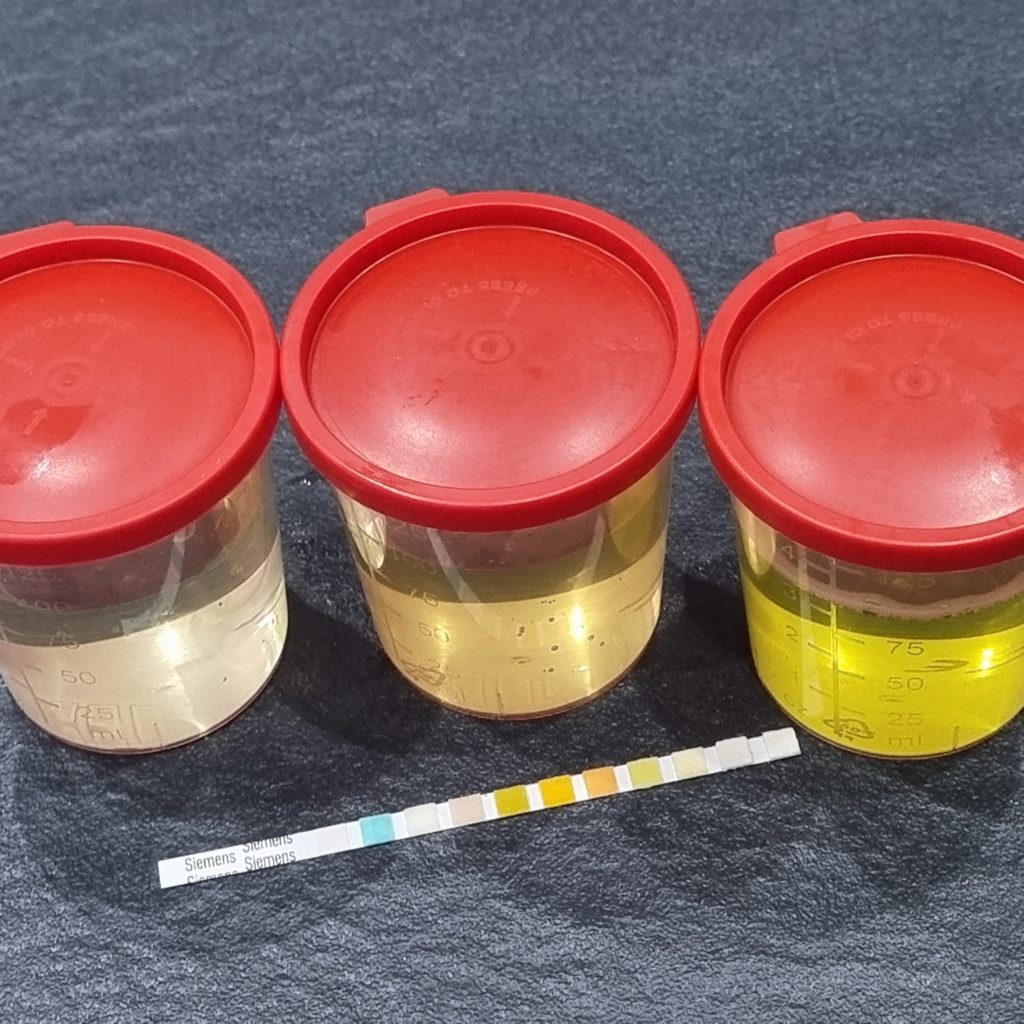Urin Schnelltest